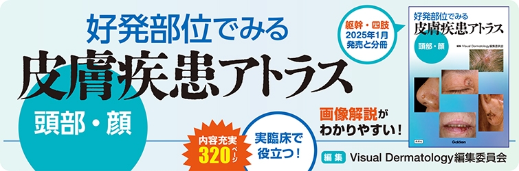 好発部位でみる皮膚疾患アトラス　頭部・顔 